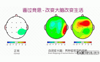 上海竞思阿斯伯格自闭症培训