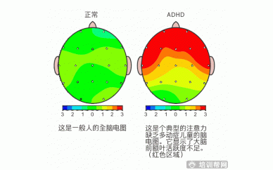 上海竞思青少年多动症培训