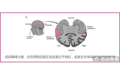 竞思青少年多动症培训